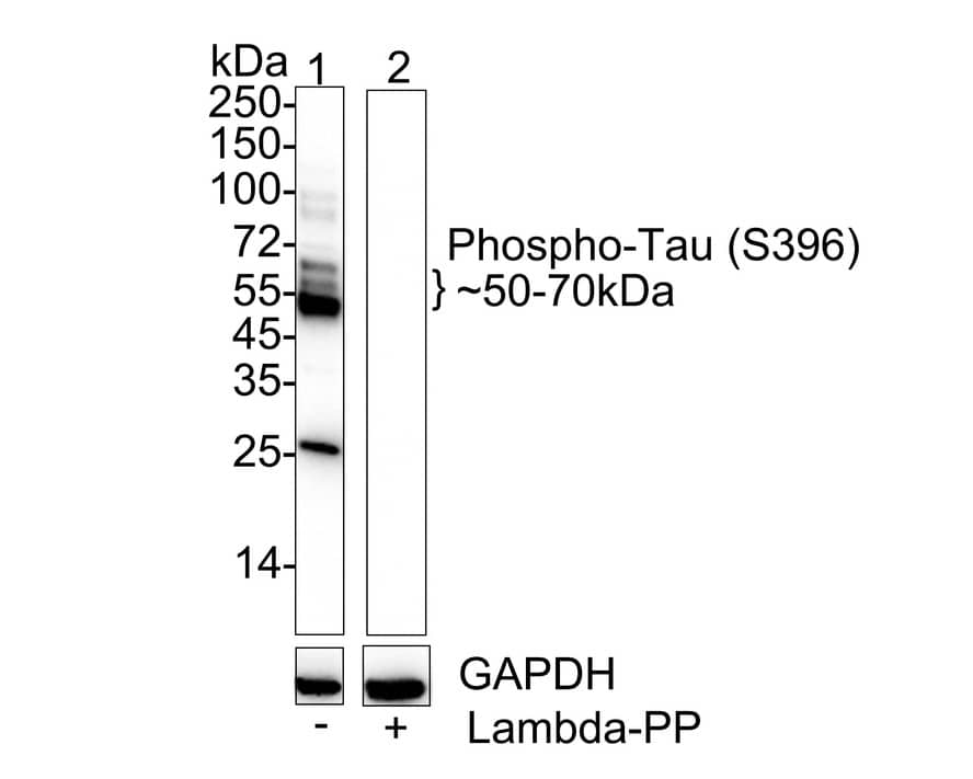 Western blot analysis on different lysates with NBP2-67702 at 1/2,000 dilution. Lane 1: Mouse brain tissue lysate Lane 2: Mouse brain tissue lysate treated with lambda-PP for 30 minutes Lysates/proteins at 40 µg/Lane. Predicted band size: 79 kDa Observed band size: 50-70, 130 kDa Exposure time: 10 seconds; 4-20% SDS-PAGE gel. Proteins were transferred to a PVDF membrane and blocked with 5% NFDM/TBST for 1 hour at room temperature. NBP2-67702 at 1/2,000 dilution was used in 5% NFDM/TBST at 4℃ overnight. Goat Anti-Rabbit IgG [HRP] Secondary Antibody at 1/50,000 dilution was used for 1 hour at room temperature.