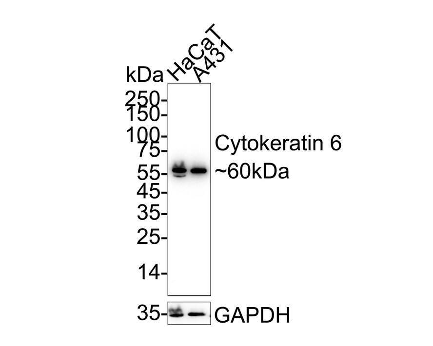 Western blot analysis on different lysates with NBP2-67705 at 1/1,000 dilution. Lane 1: HaCaT cell lysate Lane 2: A431 cell lysate Lysates/proteins at 20 µg/Lane. Predicted band size: 60 kDa Observed band size: 60 kDa Exposure time: 10 seconds;  4-20% SDS-PAGE gel. Proteins were transferred to a PVDF membrane and blocked with 5% NFDM/TBST for 1 hour at room temperature. NBP2-67705 at 1/1,000 dilution was used in 5% NFDM/TBST at 4℃ overnight. Goat Anti-Rabbit IgG [HRP] Secondary Antibody at 1/50,000 dilution was used for 1 hour at room temperature.