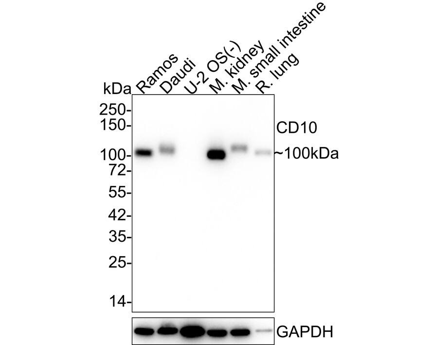Western blot analysis on different lysates with NBP2-67717 at 1/2,000 dilution. Lane 1: Ramos cell lysate (15 µg/Lane) Lane 2: Daudi cell lysate (15 µg/Lane) Lane 3: U-2 OS cell lysate (negative) (15 µg/Lane) Lane 4: Mouse kidney tissue lysate (20 µg/Lane) Lane 5: Mouse small intestine tissue lysate (20 µg/Lane) Lane 6: Rat lung tissue lysate (20 µg/Lane) Predicted band size: 86 kDa Observed band size: 100 kDa Exposure time: 24 seconds; 4-20% SDS-PAGE gel. Proteins were transferred to a PVDF membrane and blocked with 5% NFDM/TBST for 1 hour at room temperature. NBP2-67717 at 1/2,000 dilution was used in 5% NFDM/TBST at 4℃ overnight. Goat Anti-Rabbit IgG [HRP] Secondary Antibody at 1/50,000 dilution was used for 1 hour at room temperature.