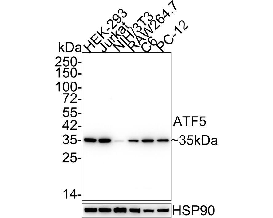 Western blot analysis on different lysates with NBP2-67767 at 1/2,000 dilution. Lane 1: HEK-293 cell lysate Lane 2: Jurkat cell lysate Lane 3: NIH/3T3 cell lysate Lane 4: RAW264.7 cell lysate Lane 5: C6 cell lysate Lane 6: PC-12 cell lysate Lysates/proteins at 15 µg/Lane. Predicted band size: 31 kDa Observed band size: 35 kDa Exposure time: 28 seconds; 4-20% SDS-PAGE gel. Proteins were transferred to a PVDF membrane and blocked with 5% NFDM/TBST for 1 hour at room temperature. NBP2-67767 at 1/2,000 dilution was used in 5% NFDM/TBST at 4℃ overnight. Goat Anti-Rabbit IgG [HRP] Secondary Antibody at 1/50,000 dilution was used for 1 hour at room temperature.