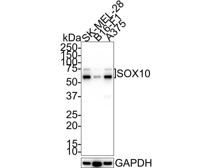 Western blot analysis on different lysates with NBP2-67812 at 1/5,000 dilution. Lane 1: SK-MEL-28 cell lysate Lane 2: B16-F1 cell lysate Lane 3: A375 cell lysate Lysates/proteins at 15 µg/Lane. Predicted band size: 50 kDa Observed band size: 60/75 kDa Exposure time: 1 minute 30 seconds; 4-20% SDS-PAGE gel. Proteins were transferred to a PVDF membrane and blocked with 5% NFDM/TBST for 1 hour at room temperature. NBP2-67812 at 1/5,000 dilution was used in 5% NFDM/TBST at 4℃ overnight. Goat Anti-Rabbit IgG [HRP] Secondary Antibody at 1/50,000 dilution was used for 1 hour at room temperature.