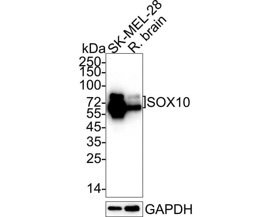 Western blot analysis on different lysates with NBP2-67812 at 1/5,000 dilution. Lane 1: SK-MEL-28 cell lysate (20 µg/Lane) Lane 2: Rat brain tissue lysate (40 µg/Lane) Predicted band size: 50 kDa Observed band size: 60/75 kDa Exposure time: 25 seconds; 4-20% SDS-PAGE gel. Proteins were transferred to a PVDF membrane and blocked with 5% NFDM/TBST for 1 hour at room temperature. NBP2-67812 at 1/5,000 dilution was used in 5% NFDM/TBST at 4℃ overnight. Goat Anti-Rabbit IgG [HRP] Secondary Antibody at 1/50,000 dilution was used for 1 hour at room temperature.