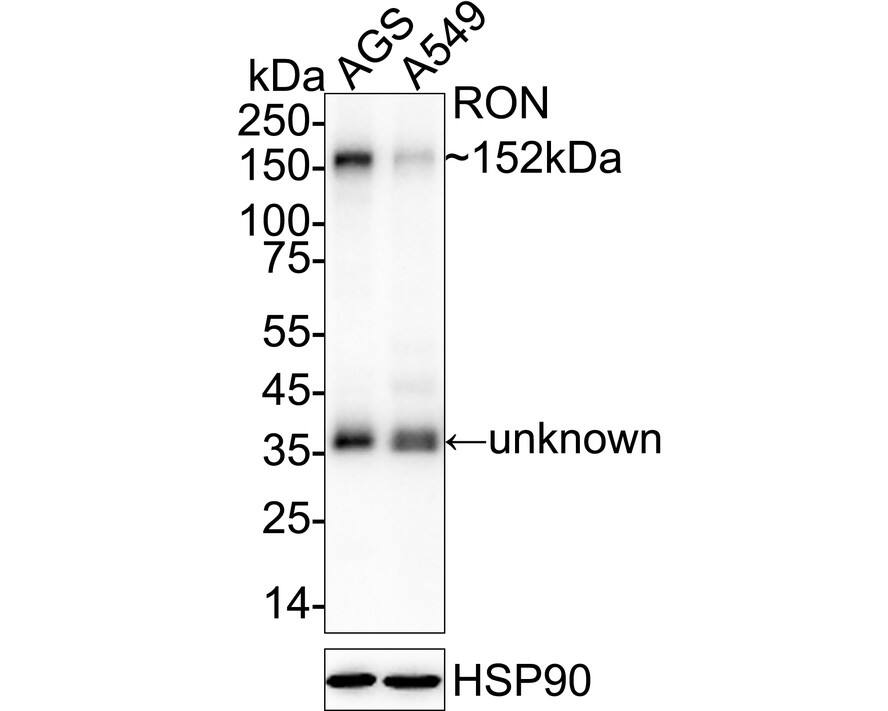 Western blot analysis on different lysates with NBP2-67814 at 1/1,000 dilution. Lane 1: AGS cell lysate Lane 2: A549 cell lysate Lysates/proteins at 20 µg/Lane. Predicted band size: 152 kDa Observed band size: 152 kDa Exposure time: 30 seconds;  4-20% SDS-PAGE gel. Proteins were transferred to a PVDF membrane and blocked with 5% NFDM/TBST for 1 hour at room temperature. NBP2-67814 at 1/1,000 dilution was used in 5% NFDM/TBST at 4℃ overnight. Goat Anti-Rabbit IgG [HRP] Secondary Antibody at 1/50,000 dilution was used for 1 hour at room temperature.