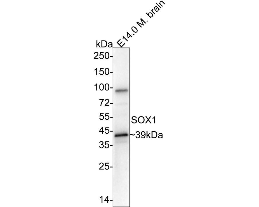 Western blot analysis of  E14.0 mouse embryonic brain tissue lysates with NBP2-67864 at 1/1,000 dilution. Lysates/proteins at 30 µg/Lane. Predicted band size: 39 kDa Observed band size: 39 kDa Exposure time: 3 minutes; 4-20% SDS-PAGE gel. Proteins were transferred to a PVDF membrane and blocked with 5% NFDM/TBST for 1 hour at room temperature. NBP2-67864 at 1/1,000 dilution was used in 5% NFDM/TBST at 4℃ overnight. Goat Anti-Rabbit IgG [HRP] Secondary Antibody at 1/50,000 dilution was used for 1 hour at room temperature.