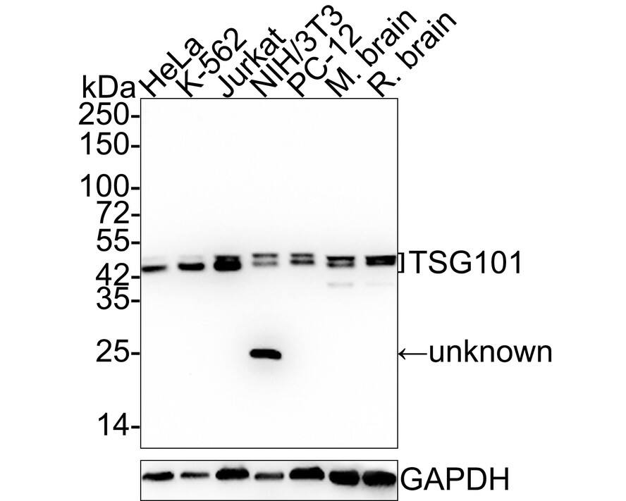 Western Blot TSG101 Antibody (JJ0900)