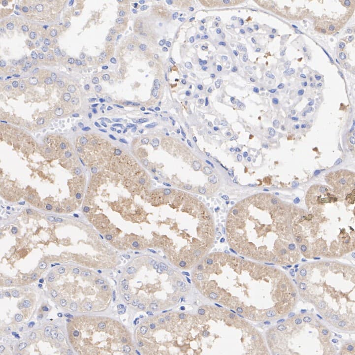 Immunohistochemistry: Rabbit Monoclonal FAT10 Antibody (JJ084-09) [NBP2-67917] - Immunohistochemical analysis of paraffin-embedded human kidney tissue with Rabbit anti-Ubiquitin D antibody (NBP2-67917) at 1/200 dilution.The section was pre-treated using heat mediated antigen retrieval with Tris-EDTA buffer (pH 9.0) for 20 minutes. The tissues were blocked in 1% BSA for 20 minutes at room temperature, washed with ddH2O and PBS, and then probed with the primary antibody (NBP2-67917) at 1/200 dilution for 1 hour at room temperature. The detection was performed using an HRP conjugated compact polymer system. DAB was used as the chromogen. Tissues were counterstained with hematoxylin and mounted with DPX.