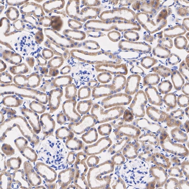 Immunohistochemistry: Rabbit Monoclonal FAT10 Antibody (JJ084-09) [NBP2-67917] - Immunohistochemical analysis of paraffin-embedded mouse kidney tissue with Rabbit anti-Ubiquitin D antibody (NBP2-67917) at 1/1,000 dilution.The section was pre-treated using heat mediated antigen retrieval with Tris-EDTA buffer (pH 9.0) for 20 minutes. The tissues were blocked in 1% BSA for 20 minutes at room temperature, washed with ddH2O and PBS, and then probed with the primary antibody (NBP2-67917) at 1/1,000 dilution for 1 hour at room temperature. The detection was performed using an HRP conjugated compact polymer system. DAB was used as the chromogen. Tissues were counterstained with hematoxylin and mounted with DPX.