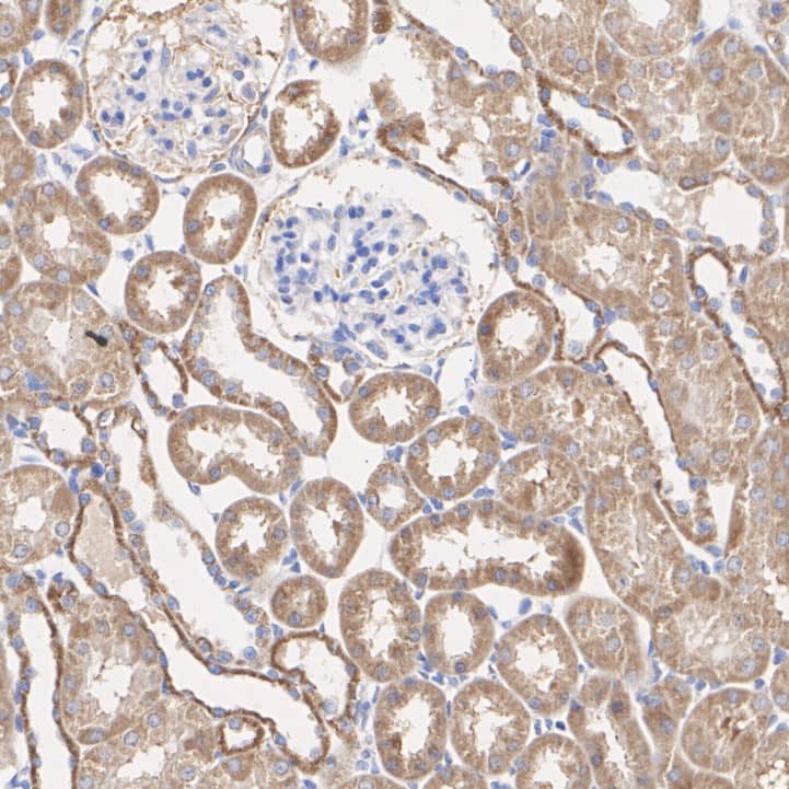 Immunohistochemistry: Rabbit Monoclonal FAT10 Antibody (JJ084-09) [NBP2-67917] - Immunohistochemical analysis of paraffin-embedded rat kidney tissue with Rabbit anti-Ubiquitin D antibody (NBP2-67917) at 1/200 dilution.The section was pre-treated using heat mediated antigen retrieval with Tris-EDTA buffer (pH 9.0) for 20 minutes. The tissues were blocked in 1% BSA for 20 minutes at room temperature, washed with ddH2O and PBS, and then probed with the primary antibody (NBP2-67917) at 1/200 dilution for 1 hour at room temperature. The detection was performed using an HRP conjugated compact polymer system. DAB was used as the chromogen. Tissues were counterstained with hematoxylin and mounted with DPX.