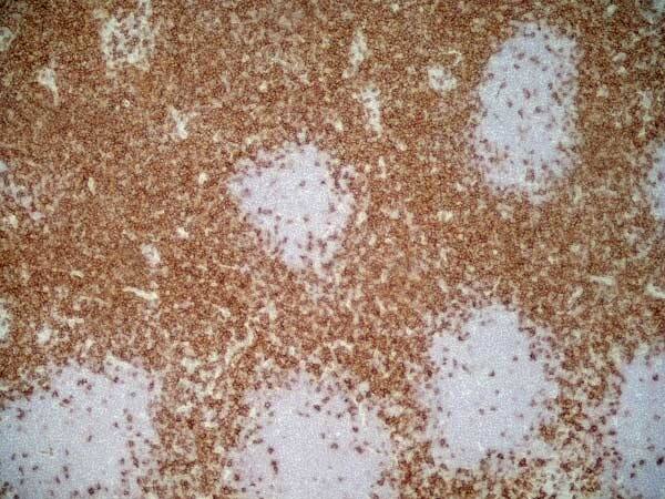 Immunohistochemistry: Goat anti-Mouse IgG1 Secondary Antibody [Alkaline Phosphatase] -  (Pre-adsorbed) [NBP2-68503] - Immunoperoxidase staining of rat lymph node cryosetion using Mouse anti Rat CD4 antibody followed by horseradish peroxidase conjugated Goat anti Mouse IgG1 for detection. Low power.