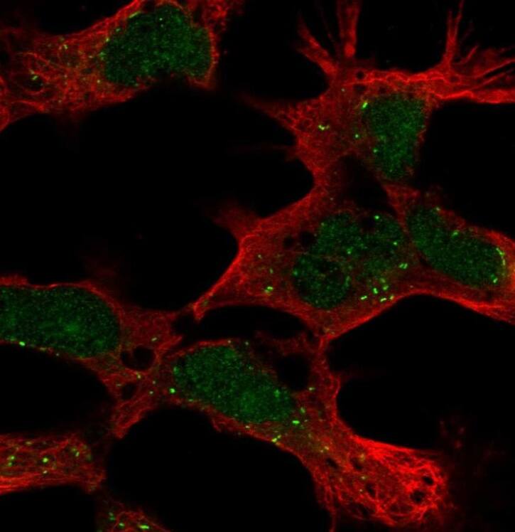  Staining of human cell line AF22 shows localization to nucleus, cytosol & vesicles.
