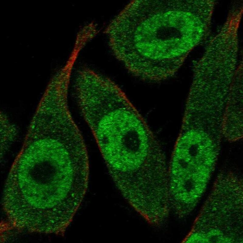 Staining of human cell line PC-3 shows localization to nucleoplasm & cytosol.