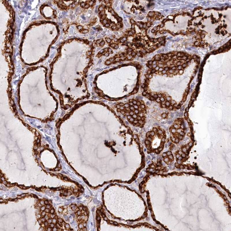 Staining of human thyroid gland shows strong cytoplasmic positivity in glandular cells.