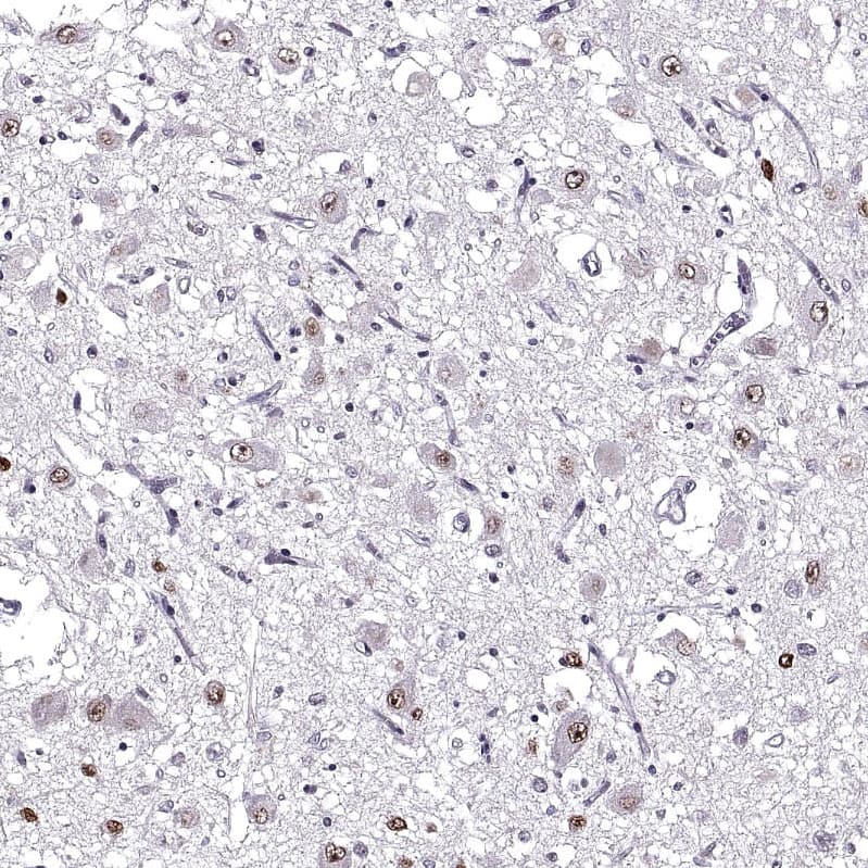 Staining of human hypothalamus shows nuclear positivity in neurons.