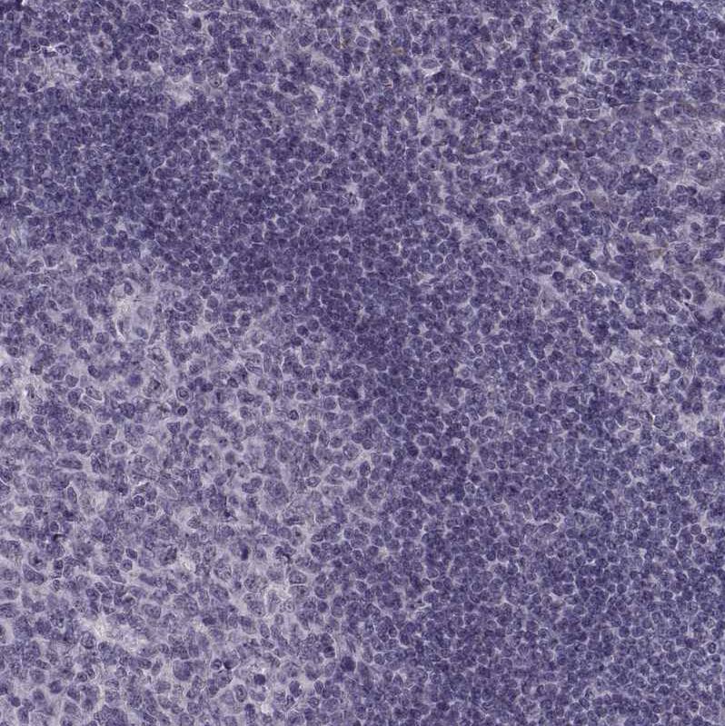 Staining of human tonsil shows no positivity in non-germinal center cells as expected.