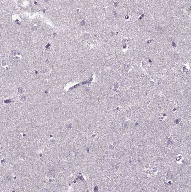 Staining of human cerebral cortex shows no positivity in neurons as expected.