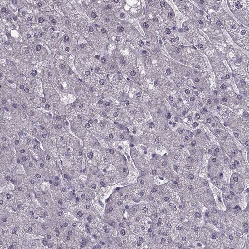 Staining of human liver shows no positivity in hepatocytes as expected.