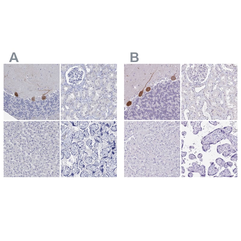 <b>Independent Antibodies Validation. </b>Staining of human cerebellum, kidney, liver and placenta using NBP2-68949 (A) shows similar protein distribution across tissues to independent antibody NBP2-13800 (B).