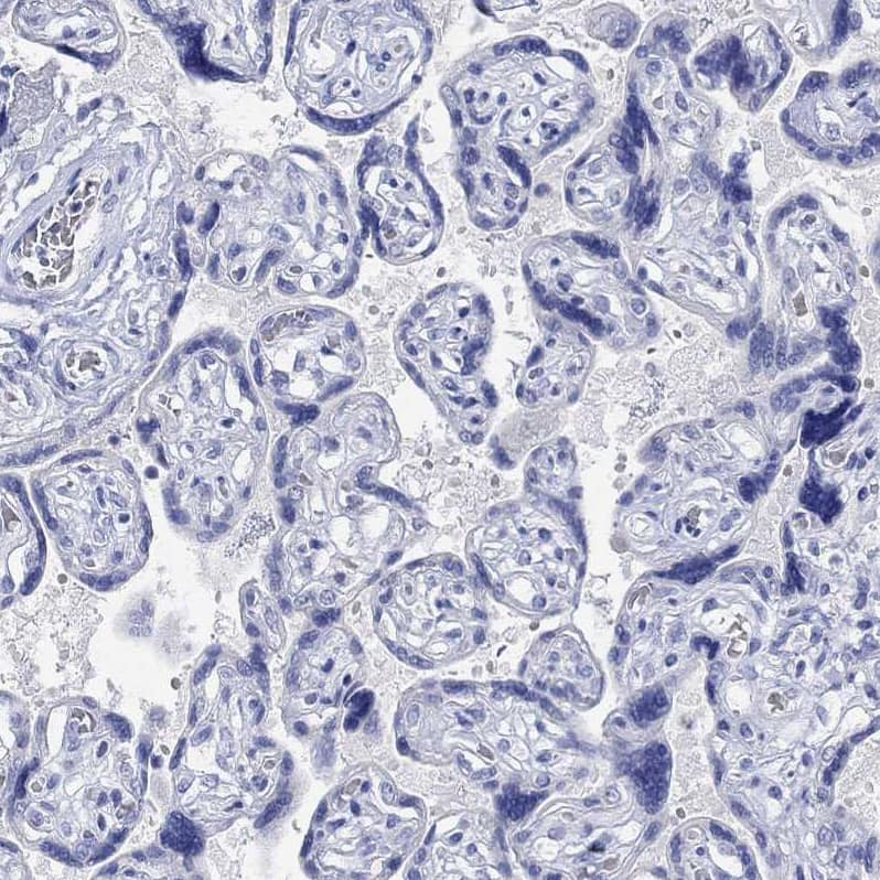 Staining of human placenta shows no positivity in trophoblastic cells as expected.