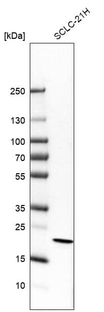 Analysis in human cell line SCLC-21H.