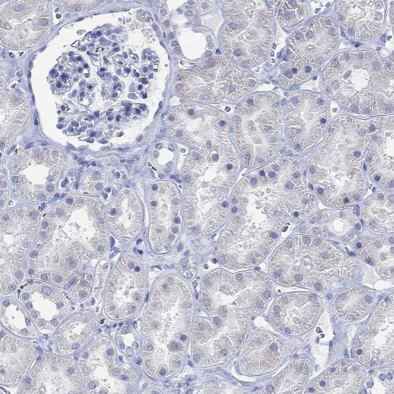 Staining of human kidney shows no positivity in cells in tubules as expected.