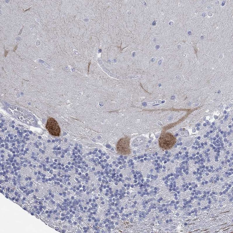 Staining of human cerebellum shows strong cytoplasmic positivity in Purkinje cells.