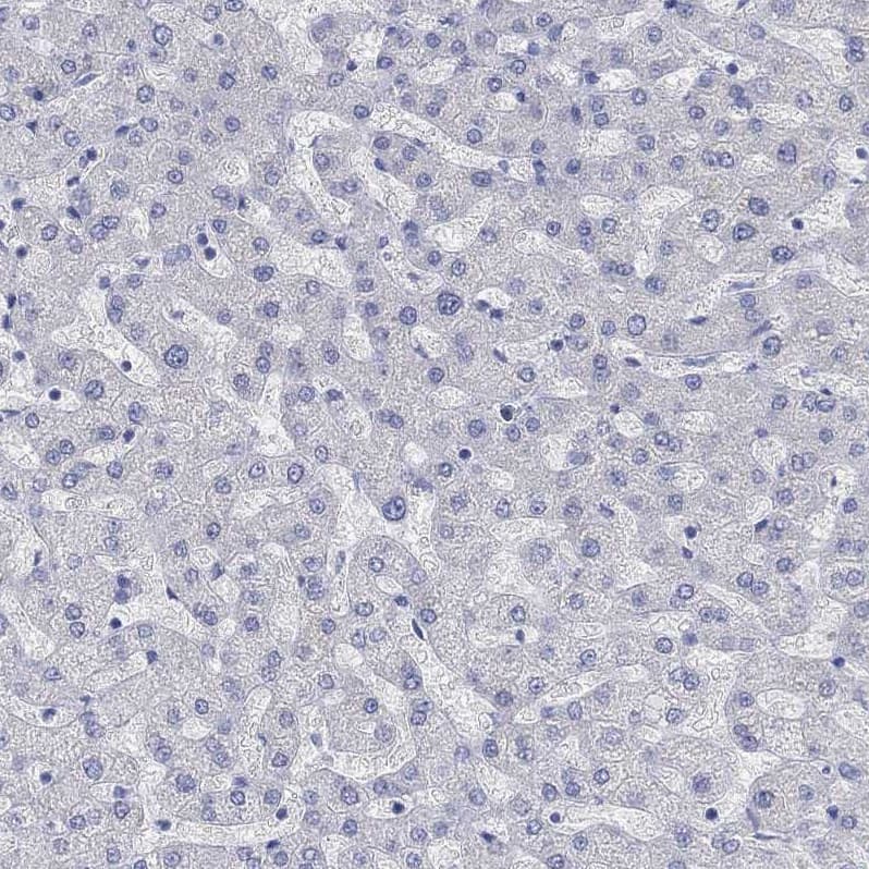 Staining of human liver shows no positivity in hepatocytes as expected.