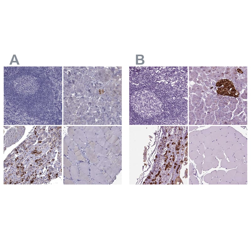 <b>Independent Antibodies Validation. </b>Staining of human lymphoid tissues, pancreas, pituitary gland and skeletal muscle using NBP2-68983 (A) shows similar protein distribution across tissues to independent antibody NBP1-90312 (B).