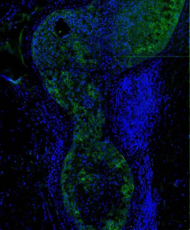 Immunohistochemistry-Paraffin - Carbonic Anhydrase XII/CA12 Antibody (OTI2C6) [FITC] [NBP2-70329F] - Carbonic Anhydrase XII/CA12 Immunofluorescence on Human Formalin-Fixed Paraffin-Embedded (FFPE) Breast tissue. Image from verified customer review.