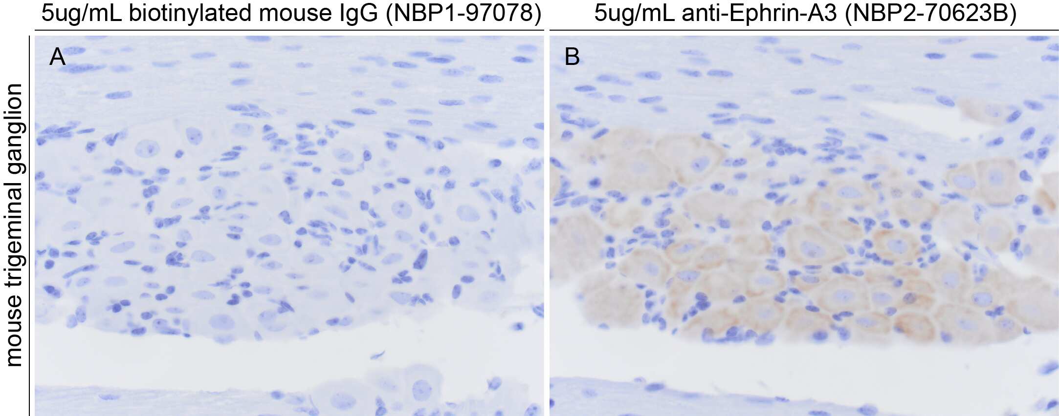 Immunohistochemistry-Paraffin: Ephrin-A3 Antibody (OTI4A4) [Biotin] [NBP2-70623B] - Ephrin-A3 immunoreactivity in mouse trigeminal ganglion neurons. Sections were incubated with the antibody overnight at 4 degrees. Biotinylated mouse IgG was used to help verify the specificity of the antibody (NBP1-97078). Image from verified customer review.
