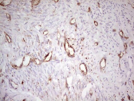 Immunohistochemistry:MDR1/ABCB1 Antibody (OTI1A7) - Azide and BSA Free[NBP2-72607]