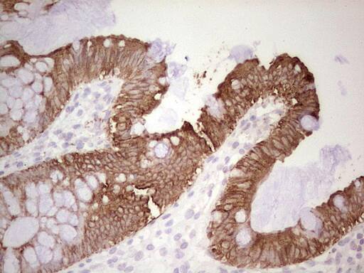 Immunohistochemistry:MDR1/ABCB1 Antibody (OTI1A7) - Azide and BSA Free[NBP2-72607]