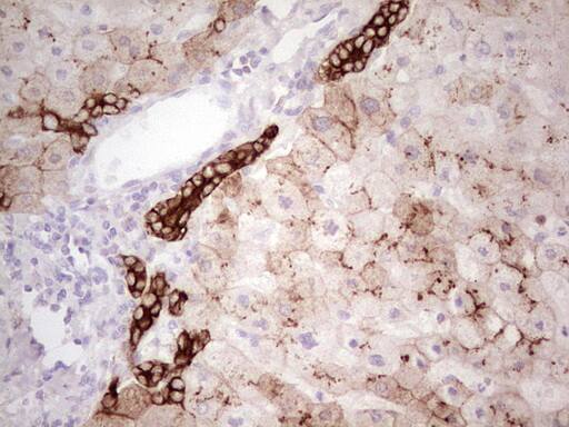 Immunohistochemistry:MDR1/ABCB1 Antibody (OTI1A7) - Azide and BSA Free[NBP2-72607]