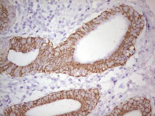 Immunohistochemistry:MDR1/ABCB1 Antibody (OTI1A7) - Azide and BSA Free[NBP2-72607]