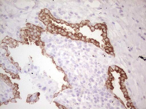 Immunohistochemistry:MDR1/ABCB1 Antibody (OTI1A7) - Azide and BSA Free[NBP2-72607]