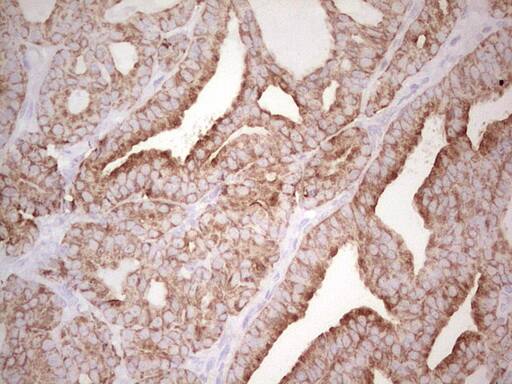 Immunohistochemistry:MDR1/ABCB1 Antibody (OTI1A7) - Azide and BSA Free[NBP2-72607]