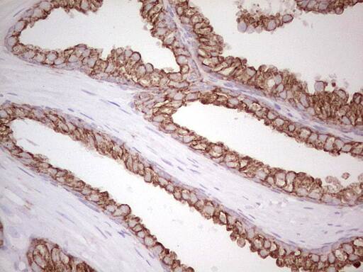 Immunohistochemistry:MDR1/ABCB1 Antibody (OTI1A7) - Azide and BSA Free[NBP2-72607]