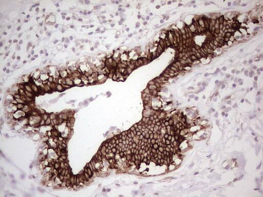 Immunohistochemistry:MDR1/ABCB1 Antibody (OTI1A7) [NBP2-72607]