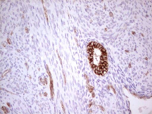 Immunohistochemistry:MDR1/ABCB1 Antibody (OTI1A7) - Azide and BSA Free[NBP2-72607]
