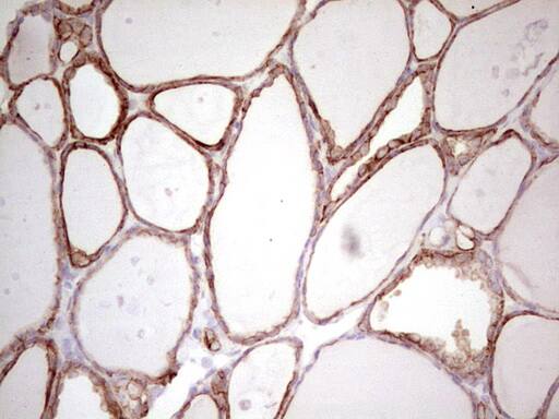 Immunohistochemistry:MDR1/ABCB1 Antibody (OTI1A7) - Azide and BSA Free[NBP2-72607]