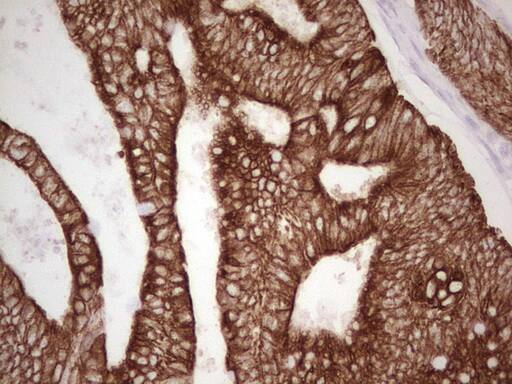Immunohistochemistry:MDR1/ABCB1 Antibody (OTI1A7) - Azide and BSA Free[NBP2-72607]