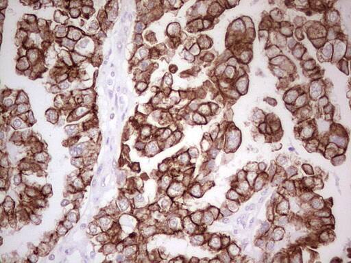 Immunohistochemistry:MDR1/ABCB1 Antibody (OTI1A7) - Azide and BSA Free[NBP2-72607]