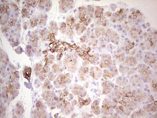 Immunohistochemistry:MDR1/ABCB1 Antibody (OTI1A7) - Azide and BSA Free[NBP2-72607]