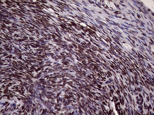 Immunohistochemistry:XRN2 Antibody (OTI5F4)[NBP3-44953]