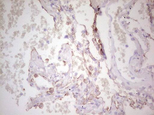 Immunohistochemistry:MDR1/ABCB1 Antibody (OTI1A7) - Azide and BSA Free[NBP2-72607]