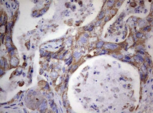 Immunohistochemistry:PI 3-Kinase p110 delta Antibody (OTI1D11) - Azide and BSA Free[NBP2-73396]