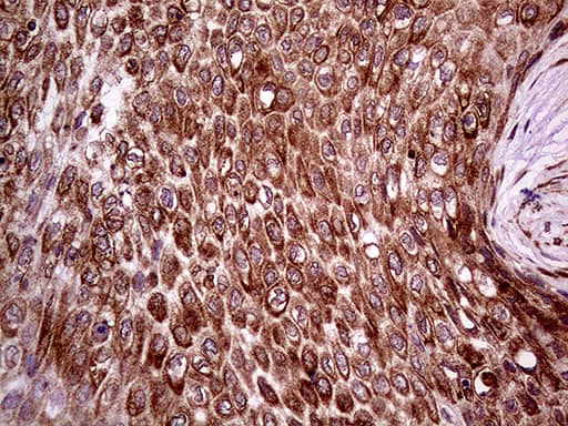 Immunohistochemistry:ERLIN1 Antibody (OTI4B1)[NBP3-44916]