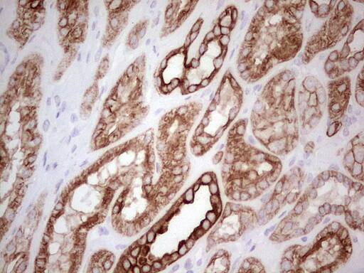 Immunohistochemistry:MDR1/ABCB1 Antibody (OTI1A7) - Azide and BSA Free[NBP2-72607]