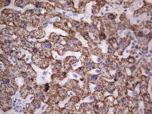 Immunohistochemistry:PI 3-Kinase p110 delta Antibody (OTI1D11) - Azide and BSA Free[NBP2-73396]