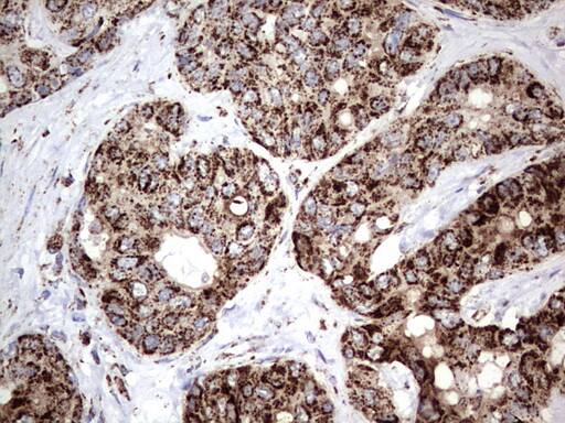 Immunohistochemistry:PI 3-Kinase p110 delta Antibody (OTI1D11) - Azide and BSA Free[NBP2-73396]