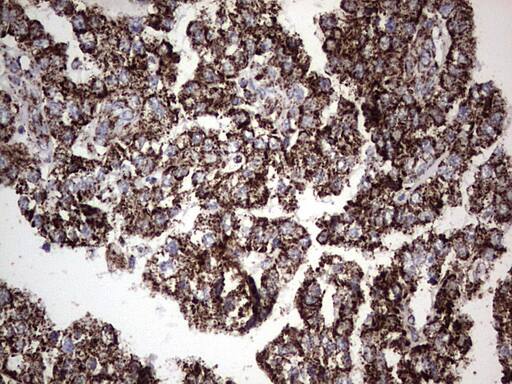 Immunohistochemistry:PI 3-Kinase p110 delta Antibody (OTI1D11) - Azide and BSA Free[NBP2-73396]